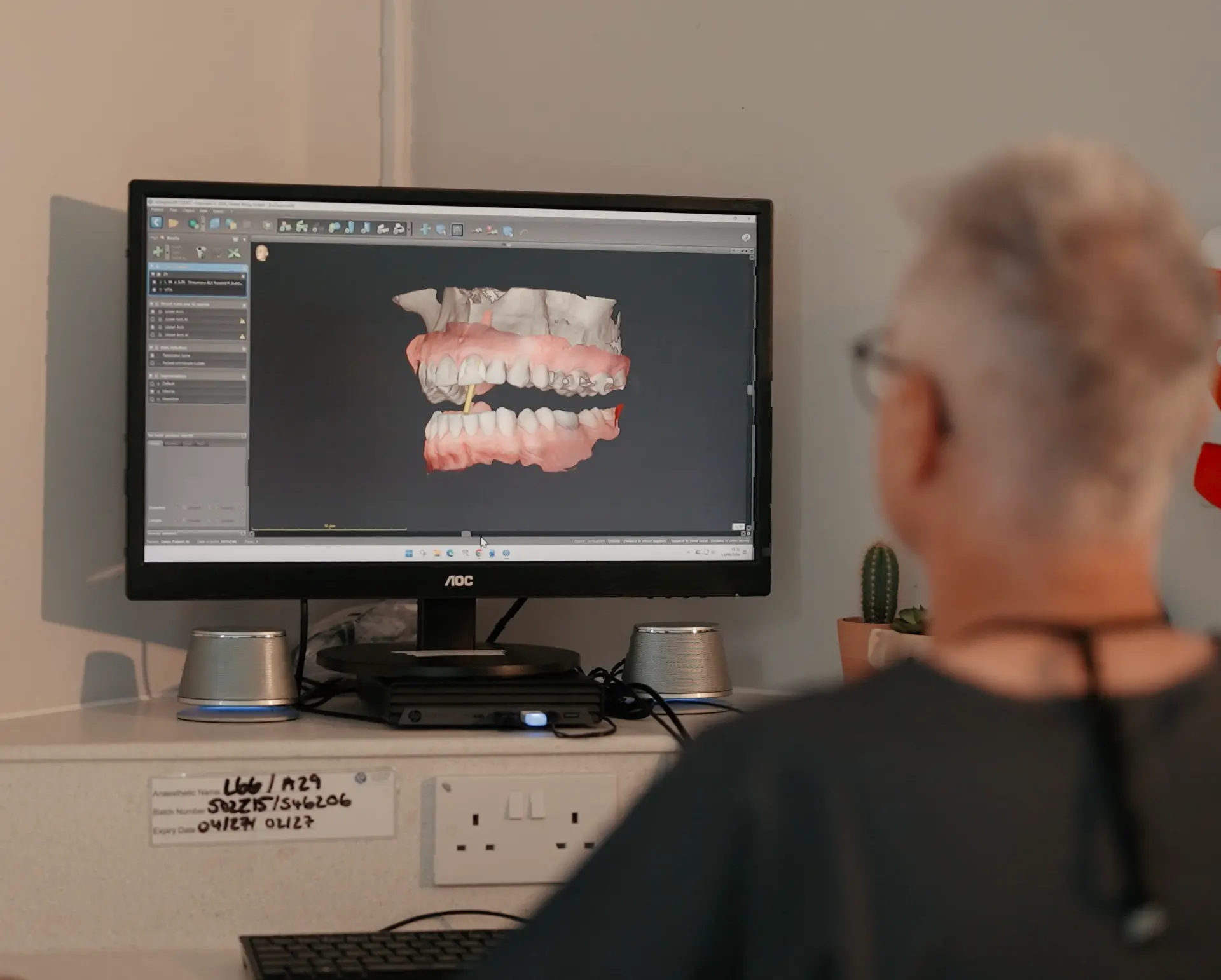 Digital 3D dental implant planning on screen at Cadbury Dental, Birmingham
