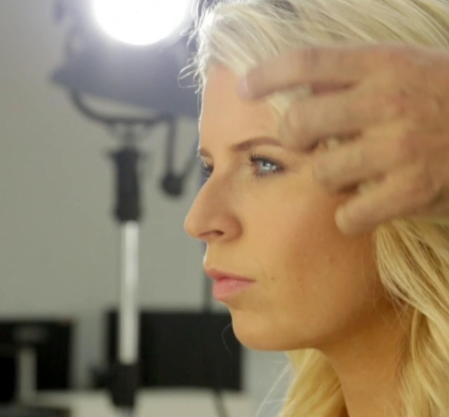 Invisalign Mikala MTM - Cadbury Dental