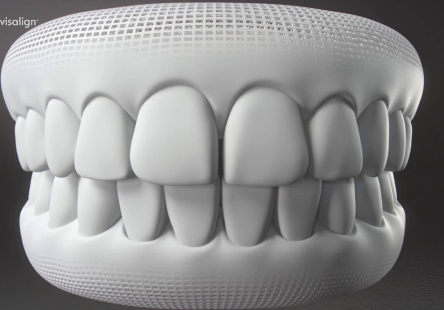 Invisalign Work - Cadbury Dental